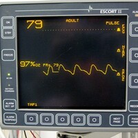 Man comes back to life 45 minutes after his heart stopped