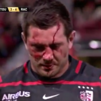 Florian Fritz sustains big knock to the head but returns to play after stitches