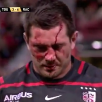 Fritz fiasco a stark reminder that rugby needs ongoing concern around head injuries