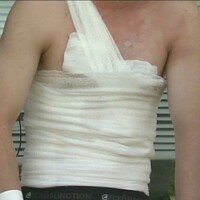 Teens are setting themselves on fire as part of a 'Facebook challenge'