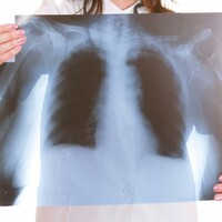 'You could have lung disease, but won't notice if your only exercise is shopping'