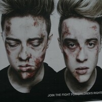 In pictures: ISPCC casts Jedward in a new light 