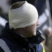 Head-butts, bites and a broken nose - but no jail time for garda attackers
