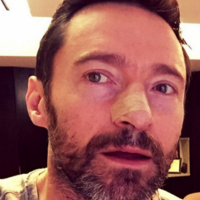 Hugh Jackman tells people to wear sunscreen after another skin cancer surgery