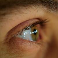 'It puts holes in the retina': Thousands at risk of blindness due to diabetes-linked eye disease