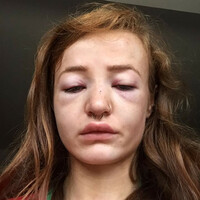 'I thought this could be it,' says 18-year-old student who was assaulted in Letterkenny