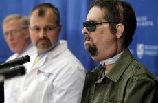 VIDEO: Full face transplant man, one year on