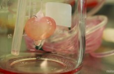 In lab ‘bio-kidney’ successfully transplanted into rat