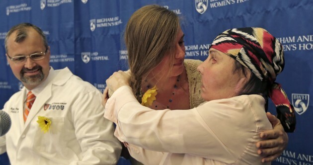 PICTURES: Daughter meets the woman who received her mum's face