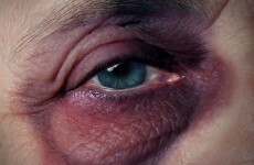 Most perpetrators of elder abuse are sons and daughters