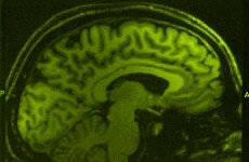 Scientists have almost found a way to predict our decisions