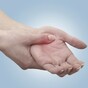 Column: “What do you mean you have arthritis? Sure you’re only a child”