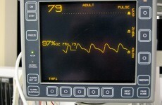 Man comes back to life 45 minutes after his heart stopped