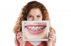 Warning about 'quick-fix' teeth straightening
