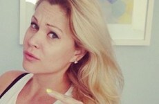NSFW: Model poses beside 2.5l of her own body fat after liposuction