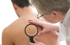 Rates of certain types of skin cancer have increased since 2002