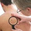 Rates of certain types of skin cancer have increased since 2002