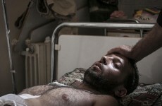 Column: Full, unimpeded access for all doctors is immediately needed in Syria