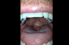 What's the most horrifying thing you can do with this new iPhone feature?