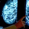 Global survey shows advanced breast cancer patients are battling isolation