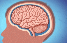 This is what happens to your brain when you get a concussion