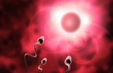 Irish researchers discovering more and more about male infertility