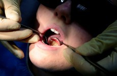 Almost 14,000 children waiting on orthodontic treatments