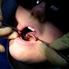 Almost 14,000 children waiting on orthodontic treatments