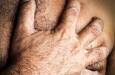 Strokes among younger people are increasing worldwide