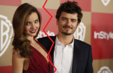 Orlando Bloom and Miranda Kerr have split up and we're really sad... it's The Dredge