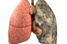 Signs You Have Unhealthy Lungs Herzindagi English