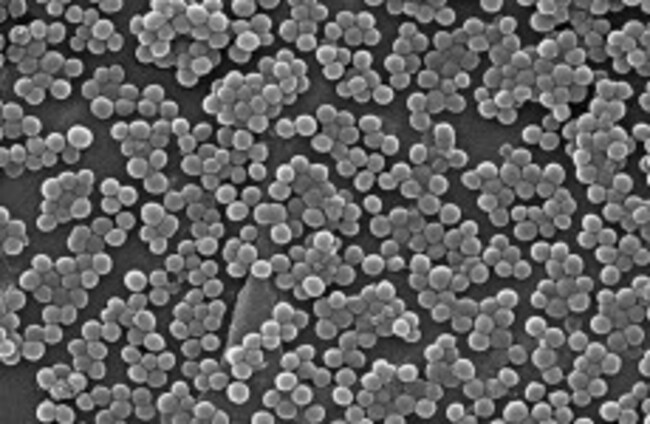 Superbugs evolving faster than medicine, worried experts warn