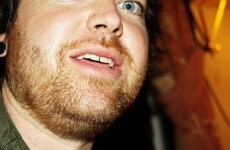 An Open Love Letter to the Men of Ireland