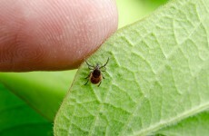 Lyme disease, the National Gallery and everything else happening in Leinster House today