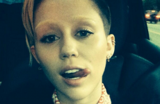 Where in tarnation are Miley Cyrus' eyebrows? It's the Dredge