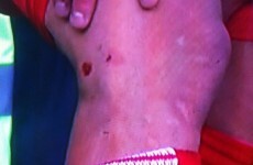 Should this challenge on Suarez have meant a red card for Kevin Mirallas?