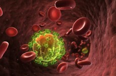Undiagnosed HIV rates high in Dublin, widespread testing recommended