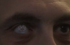 Newcastle fan gets club crest on his custom-made glass eye