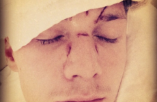 Did Lindsay Lohan organise for Paris Hilton's brother to be beaten up? It's the Dredge