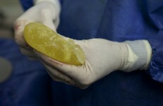 Founder of French breast implant scandal firm jailed