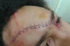 This is how one Perpignan player looked after the defeat to Munster... thanks to his own team-mate