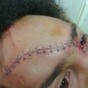 This is how one Perpignan player looked after the defeat to Munster... thanks to his own team-mate
