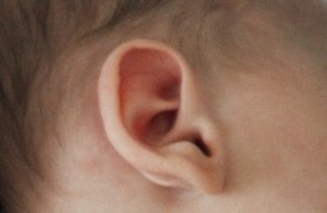 Baby who survived meningitis gets chance to hear again after ‘ground-breaking’ op