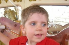 HSE to fund bilateral cochlear implants for 100 children