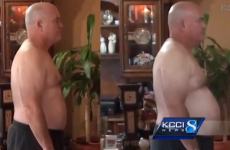 Man eats only McDonalds for 3 months, ends up healthier than he started