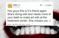 Tweet Sweeper: Ke$ha wants you to send her your teeth... seriously
