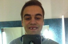 TheScore.ie helped this Irish rugby star locate his missing teeth