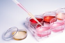 New stem cell discovery made - but Ireland "far behind" with legislation