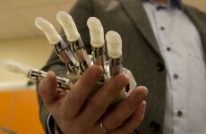 This bionic hand can sense shape and texture