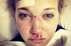 Here's how 18-year-old Rowan Cheshire looks after crashing on Sochi halfpipe